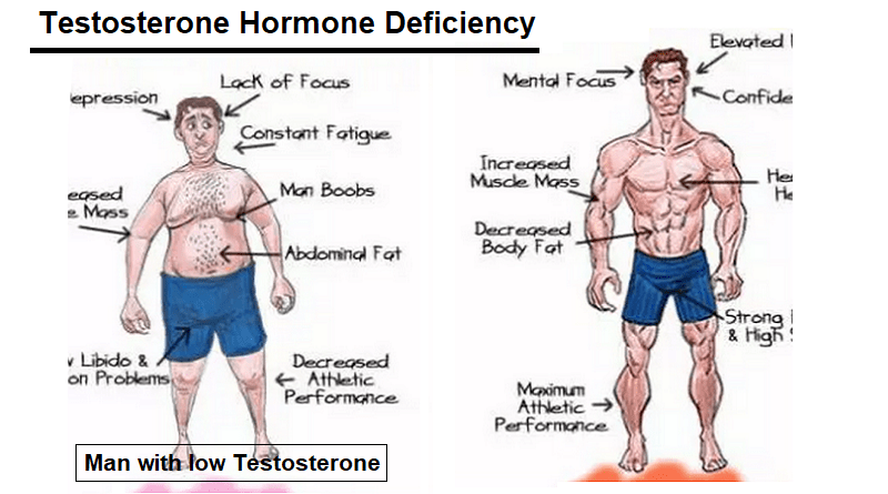 Testosterone Hormone Deficiency: Causes, Symptoms and Treatment