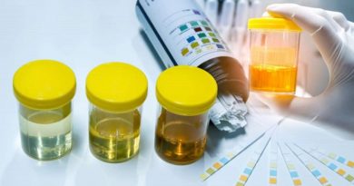 Urine Color Change: Most Common 5 Causes