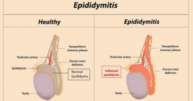 Epididymis inflammation