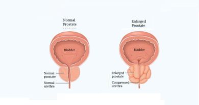 The Prostate gland