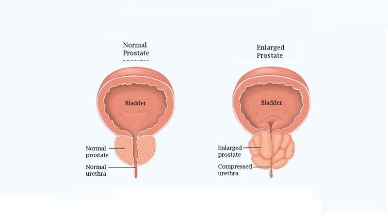 The Prostate gland