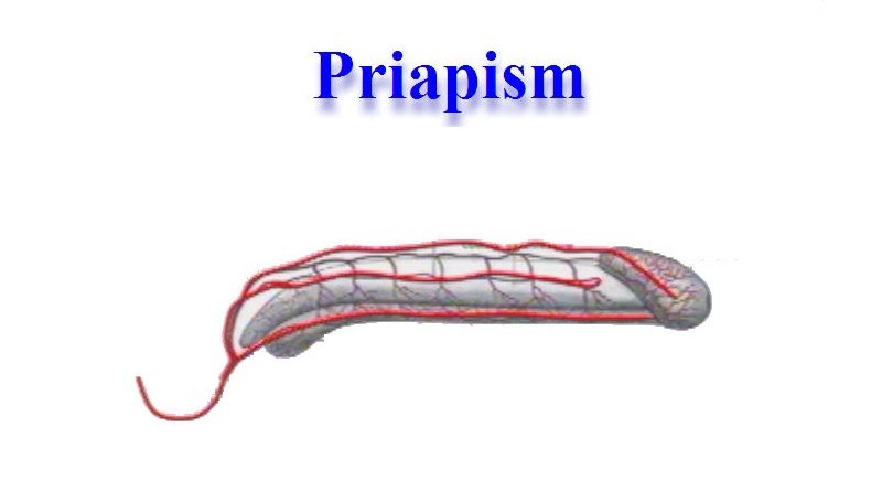 priapism