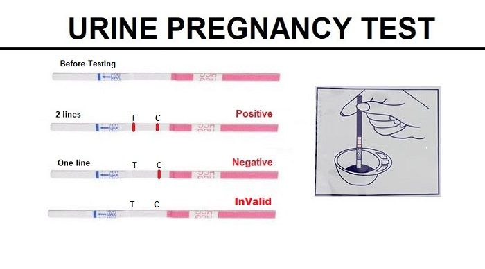 5 best home pregnancy tests available in the Philippines