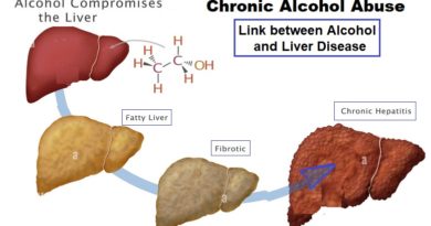 Chronic Alcohol Abuse: Understanding the Link between Alcohol and Liver Disease