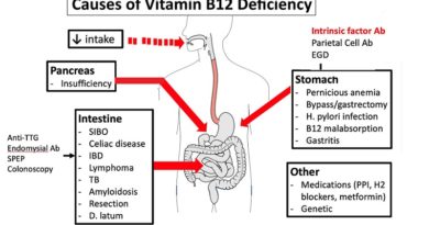 Causes of Vitamin B12 Deficiency