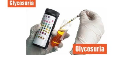 Glucose in Urine: The Difference Between Glycosuria and Glucosuria