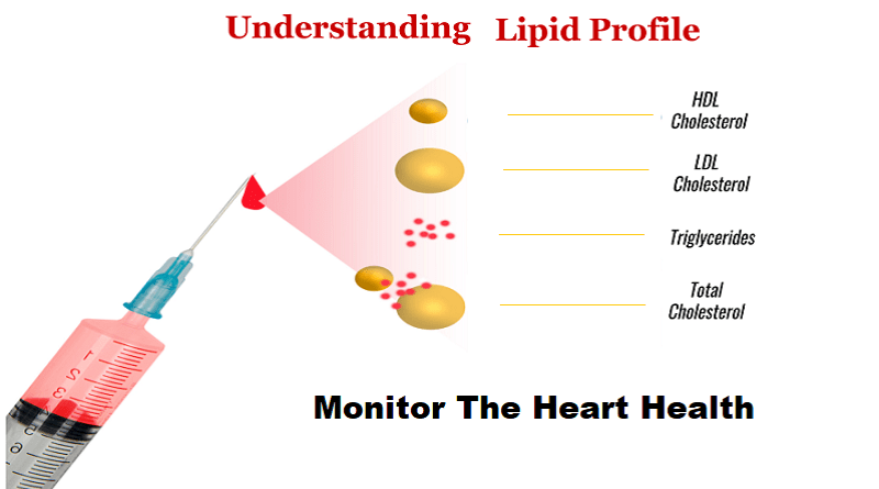 lipid profile testing