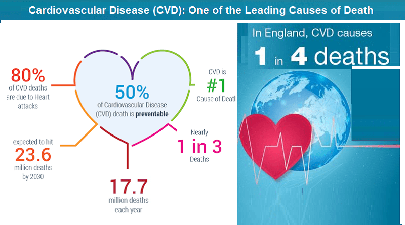 Cardiovascular Disease (CVD): One of the Leading Causes of Death Globally