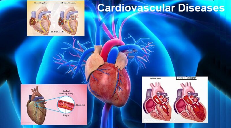 Understanding Cardiovascular Diseases