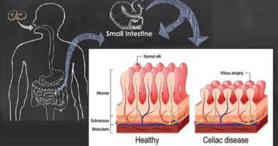 Exploring Celiac Disease and its Impact: Unveiling the Mystery