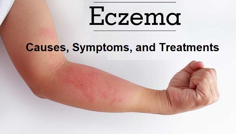 Eczema Causes, Symptoms, and Treatments