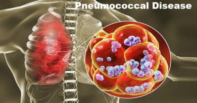 Pneumococcal Disease: Unveiling the Silent Threat