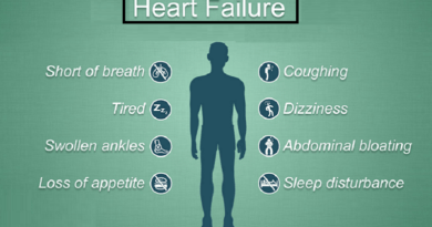 Heart Failure: Causes, Symptoms, and Treatment