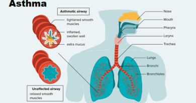 Asthma and Its Impact on Your Life