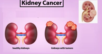 Kidney Cancer