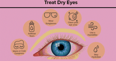 Dry Eyes: Understanding the Causes and Management
