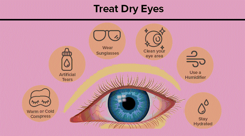 Dry Eyes: Understanding the Causes and Management