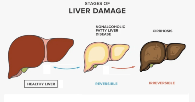 Liver Disease and its Impact on Health