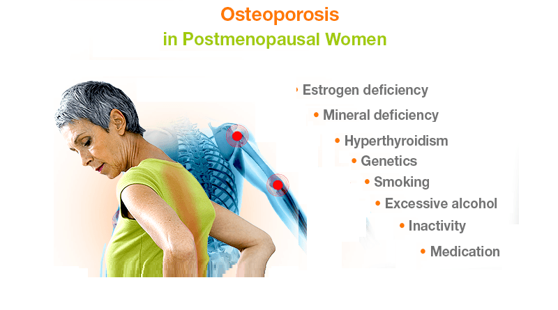 Postmenopausal Osteoporosis
