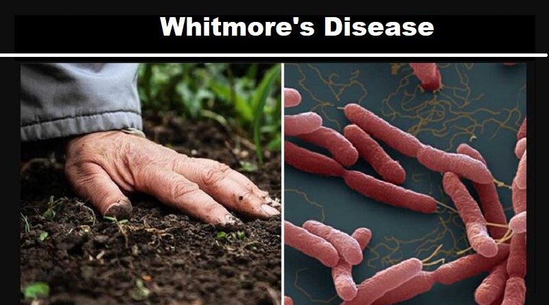 Whitmore's Disease: An Emerging Health Concern