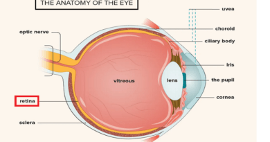Retinal Diseases: Types, Causes, and Symptoms