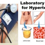 Laboratory Tests for Hypertension: The Most Commonly Requested
