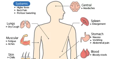 Malaria: Causes, Symptoms, and Treatment
