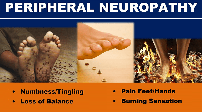 neuropathy peripheral