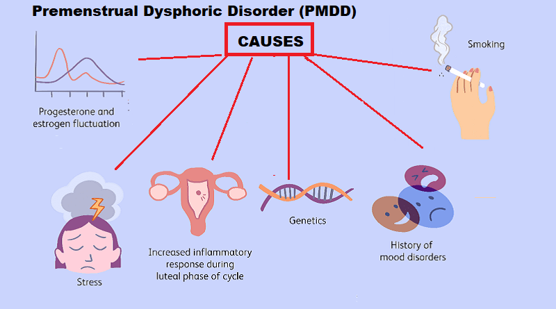 Premenstrual Dysphoric Disorder (PMDD)