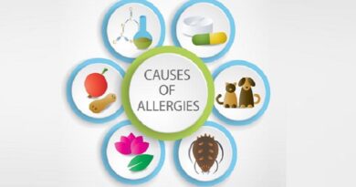 Allergy Causes, Symptoms, and How to Manage