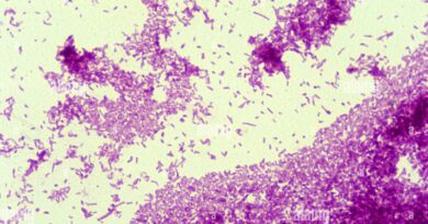Mycobacterium tuberculosis bacteria under microscope