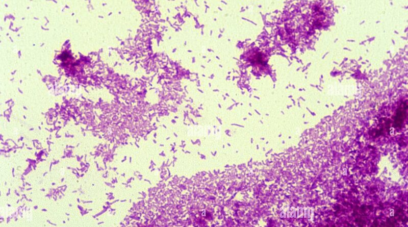 Mycobacterium tuberculosis bacteria under microscope