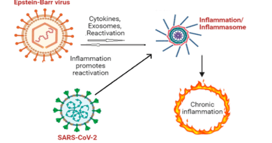 Epstein-Barr virus
