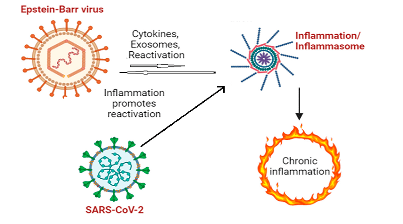 Epstein-Barr virus