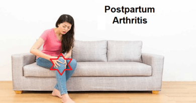 Postpartum Arthritis