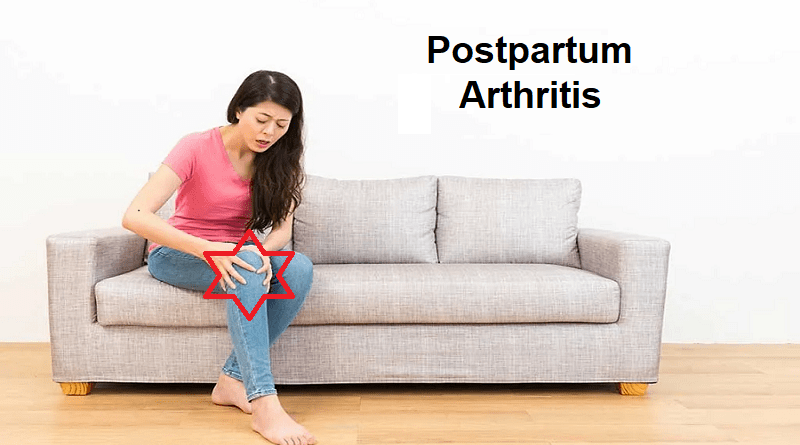 Postpartum Arthritis