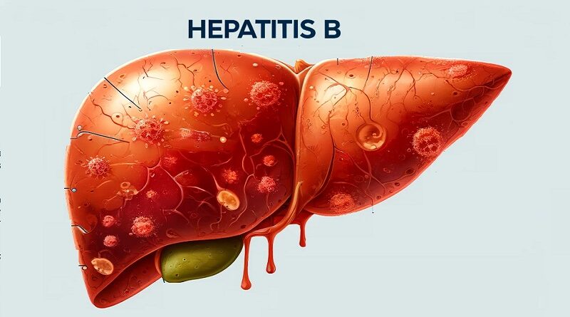 Understanding Hepatitis B: A Comprehensive Guide for HepaB Virus