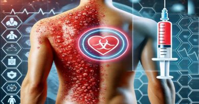 Shingles (Herpes Zoster) and the Importance of Vaccination