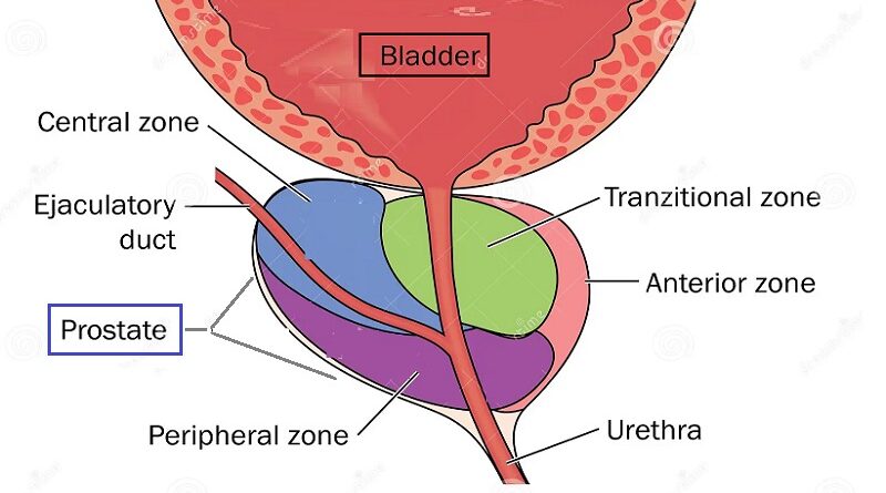 Prostate Cancer: Understanding the Silent Battle Within