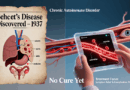 Behcet's Disease Treatment Options