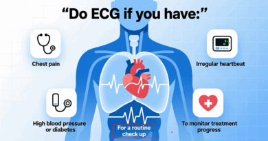 ECG
