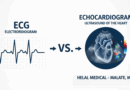 ECG vs. Echocardiogram