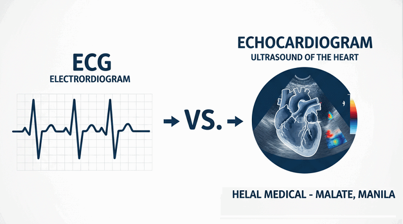 ECG vs. Echocardiogram