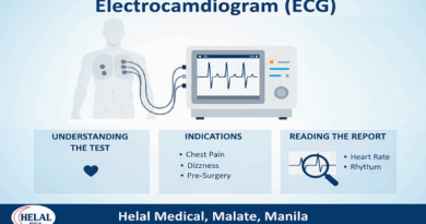 Electrocardiogram (ECG) It's Indications, and How to Read the Report