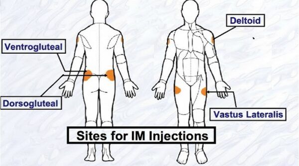 Intramuscular (IM) Injection: Comprehensive Guide for Filipinos