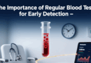Learn why regular blood tests are vital for early disease detection among Filipinos. Discover what tests to get and how often to monitor your health.