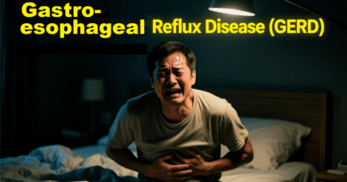Gastroesophageal reflux disease (GERD)